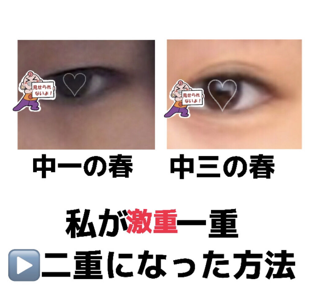 アイトーク/アイトーク/二重まぶた用アイテムを使ったクチコミ（1枚目）