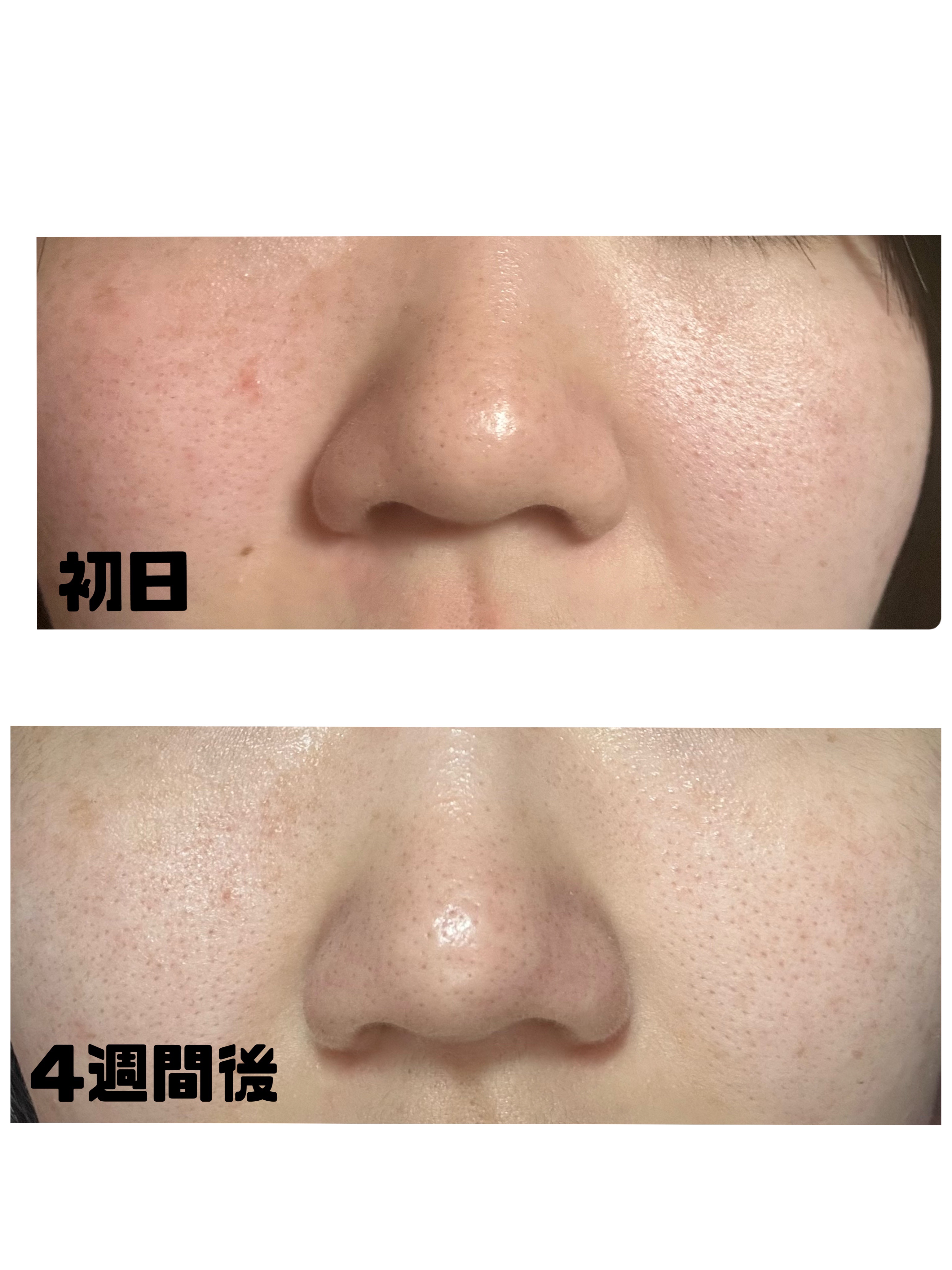 菊正宗 日本酒の化粧水 高保湿/菊正宗/化粧水を使ったクチコミ（2枚目）