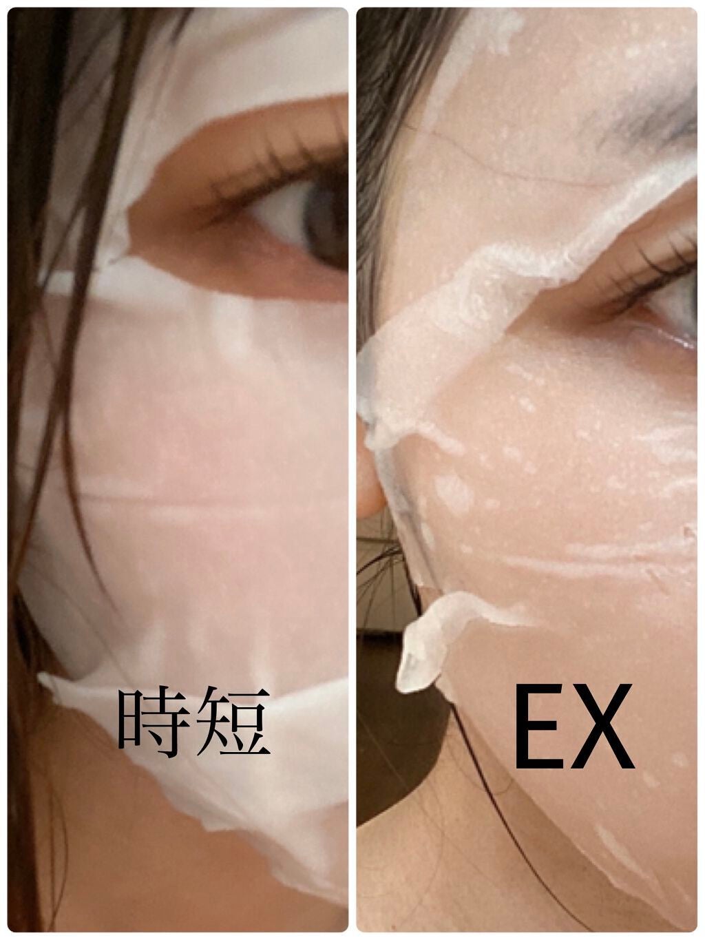 ティーツリーケア ソリューション エッセンシャルマスクEX/MEDIHEAL/シートマスク・パックを使ったクチコミ(2枚目)