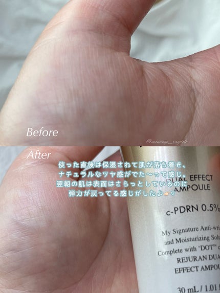 REJURAN デュアル エフェクト アンプル 30mL/REJURAN COSMETICS/美容液を使ったクチコミ(5枚目)