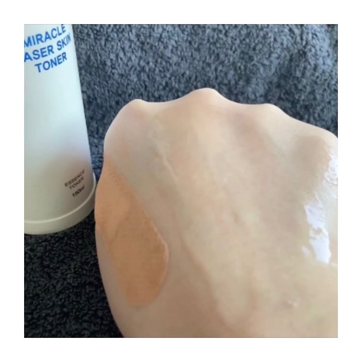 ミラクルレーザースキントナー/トアス/化粧水を使ったクチコミ(6枚目)
