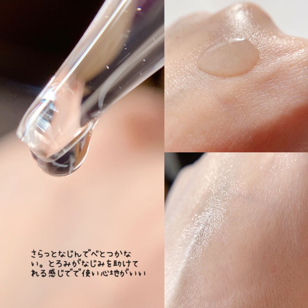 バイタルドロップ/EVERYSKIN/美容液を使ったクチコミ(5枚目)