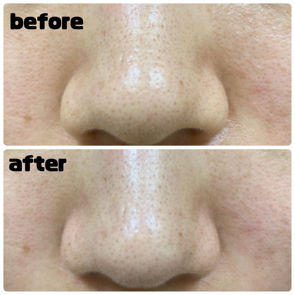 クリーンイットゼロ クレンジングバーム オリジナル/BANILA CO/クレンジングバームを使ったクチコミ（3枚目）