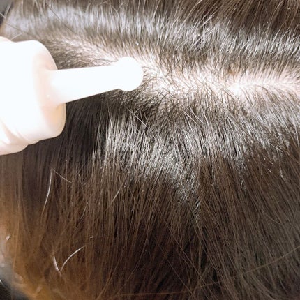 セグレタ 育毛エッセンス/花王/頭皮ローションを使ったクチコミ(1枚目)