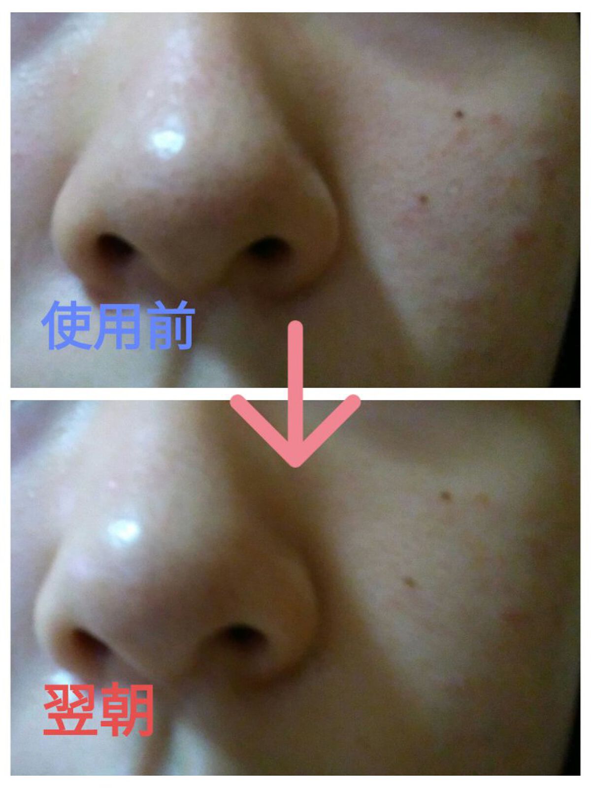 毛穴小町マスク /クリアターン/シートマスク・パックを使ったクチコミ(3枚目)