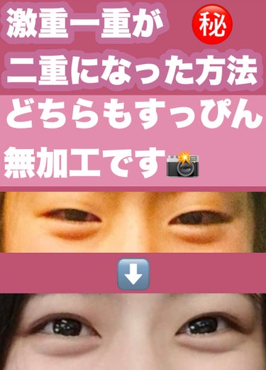 とゆめ☁️フォロバ  on LIPS 「激重一重が二重になった方法㊙️‼︎/今回は激重一重だったわたし..」（1枚目）