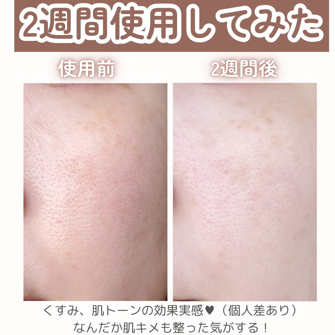 フレッシュリージュースドビタミンチャージングセラム(30ml)/Klairs/美容液を使ったクチコミ(4枚目)