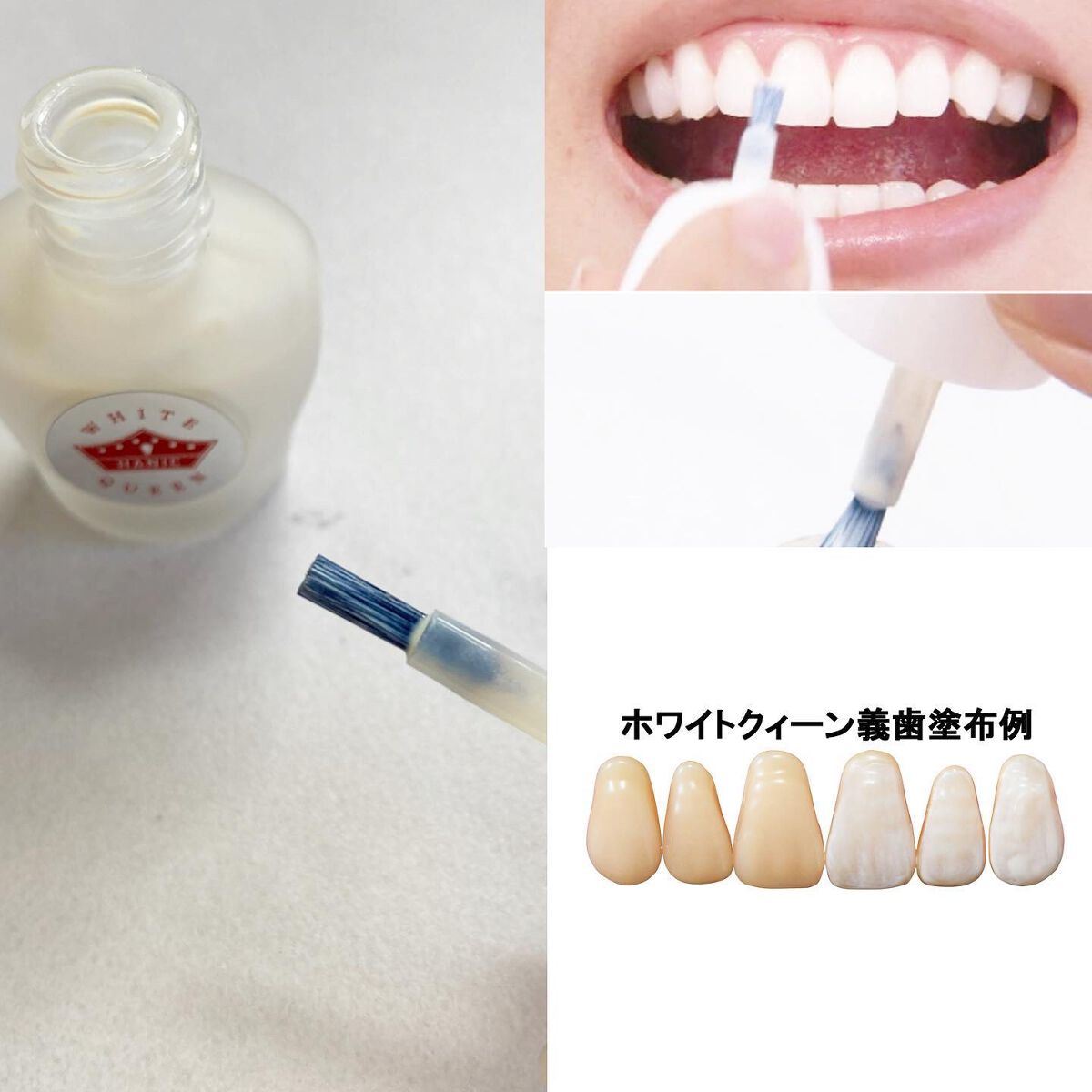 WHITE QUEEN/ハニック・ホワイトラボ/その他オーラルケアを使ったクチコミ(2枚目)
