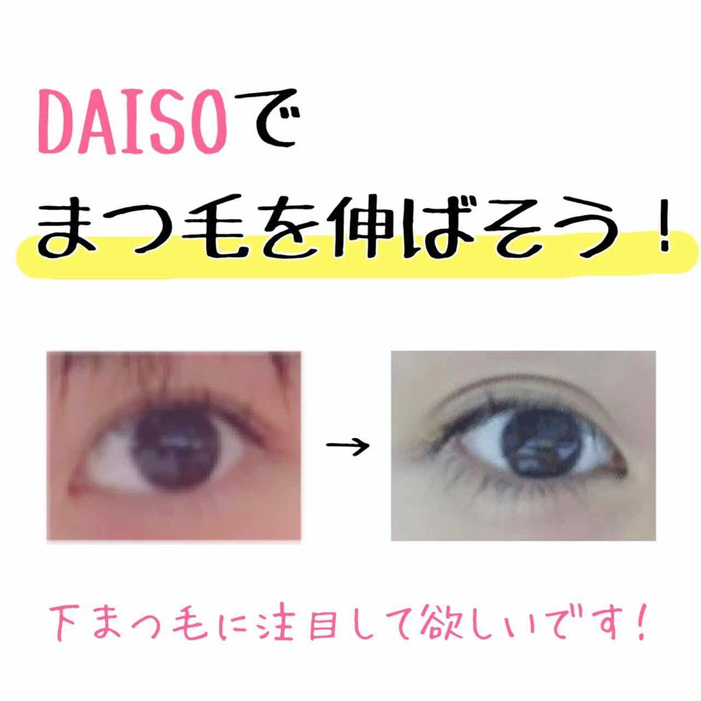 ローヤルゼリー配合 栄養ローション/DAISO/美容液を使ったクチコミ（1枚目）