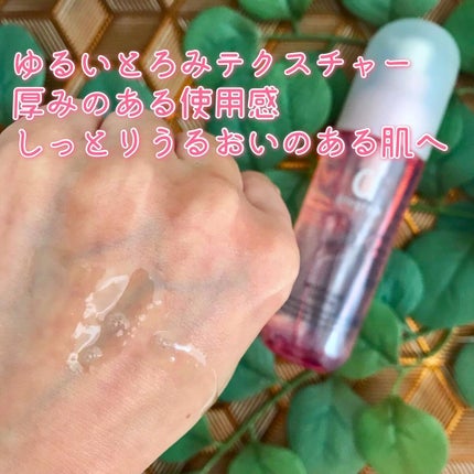 モイストケア ローション MB/d プログラム/化粧水を使ったクチコミ(5枚目)