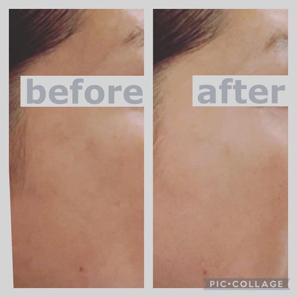 lovebeer on LIPS 「少しずつ春も近づき、気温が上がるとともに…増えてくる紫外線!朝..」(5枚目)