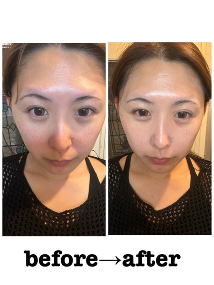 ブルートーンアップクッション/EMROSÉ/クッションファンデーションを使ったクチコミ(5枚目)