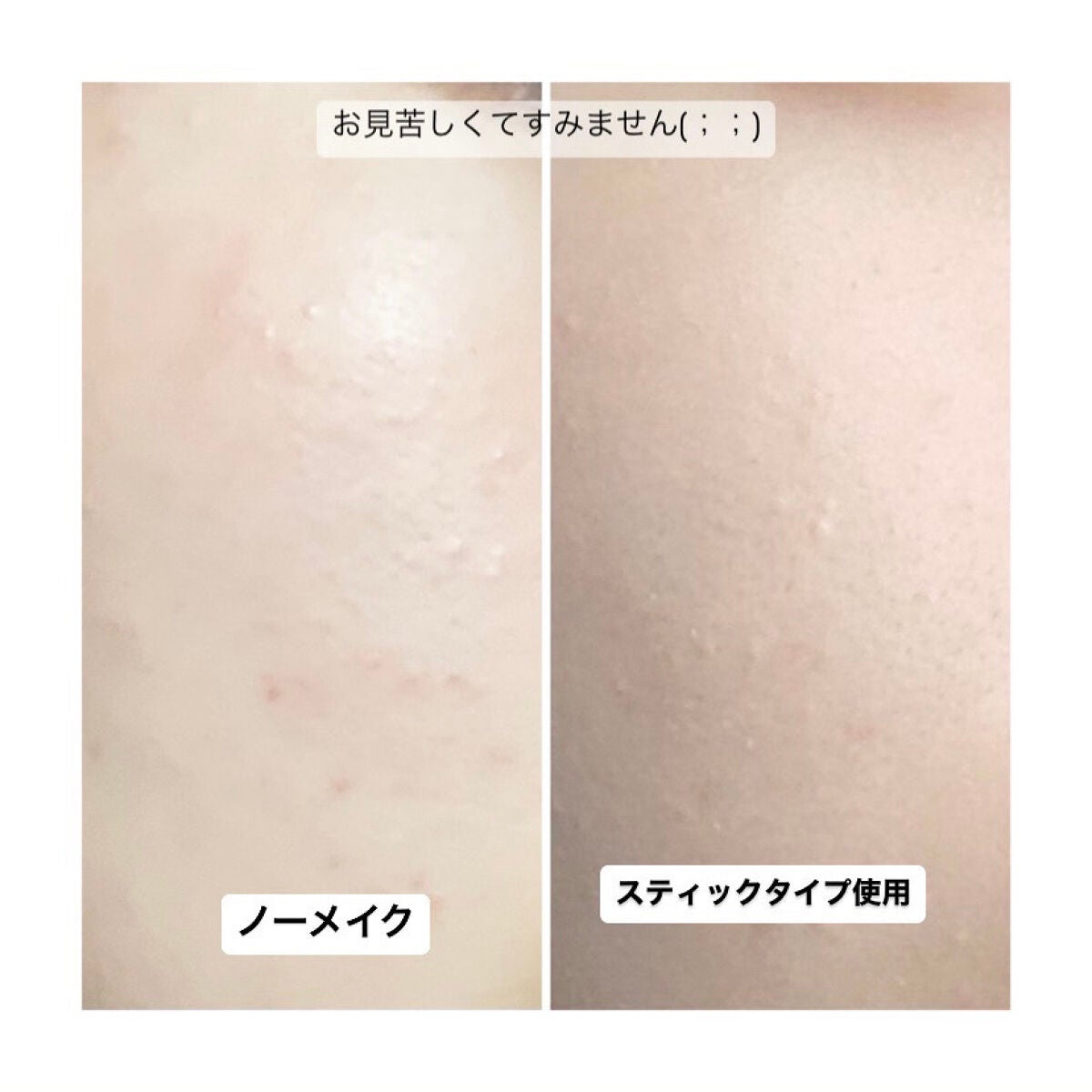 マスクフィットオールカバーデュアルコンシーラー/TIRTIR(ティルティル)/コンシーラーを使ったクチコミ(7枚目)