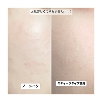 マスクフィットオールカバーデュアルコンシーラー/TIRTIR(ティルティル)/コンシーラーを使ったクチコミ(7枚目)