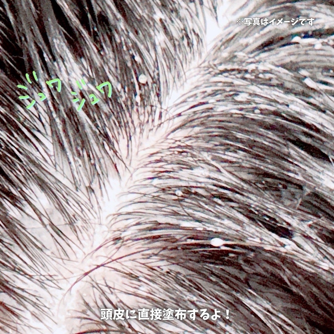 スパークリングスカルプスケーラー/ミンツリー/頭皮ケアを使ったクチコミ(6枚目)