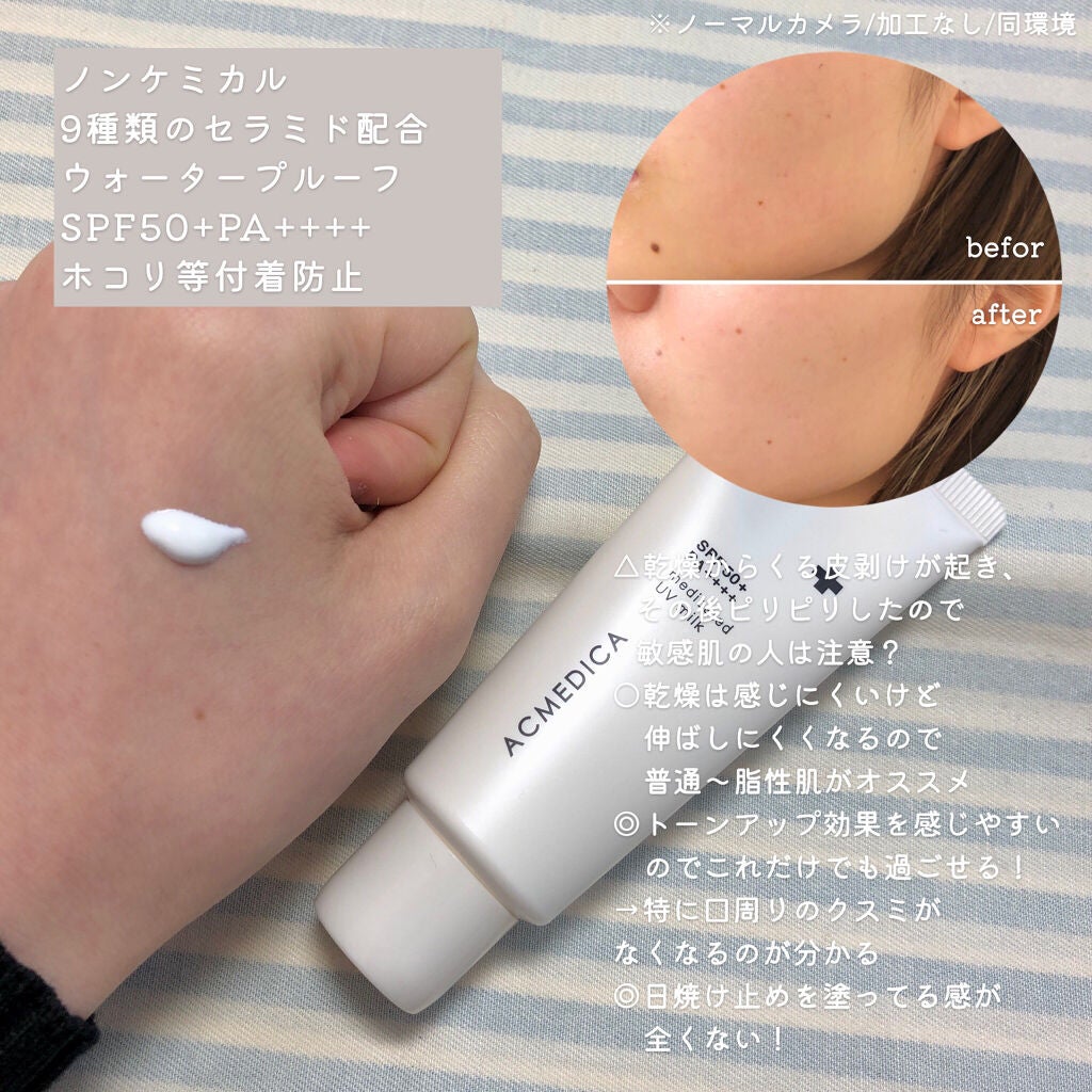 アクメディカ 薬用 UVミルク/ナリスアップ/日焼け止めミルクを使ったクチコミ(2枚目)