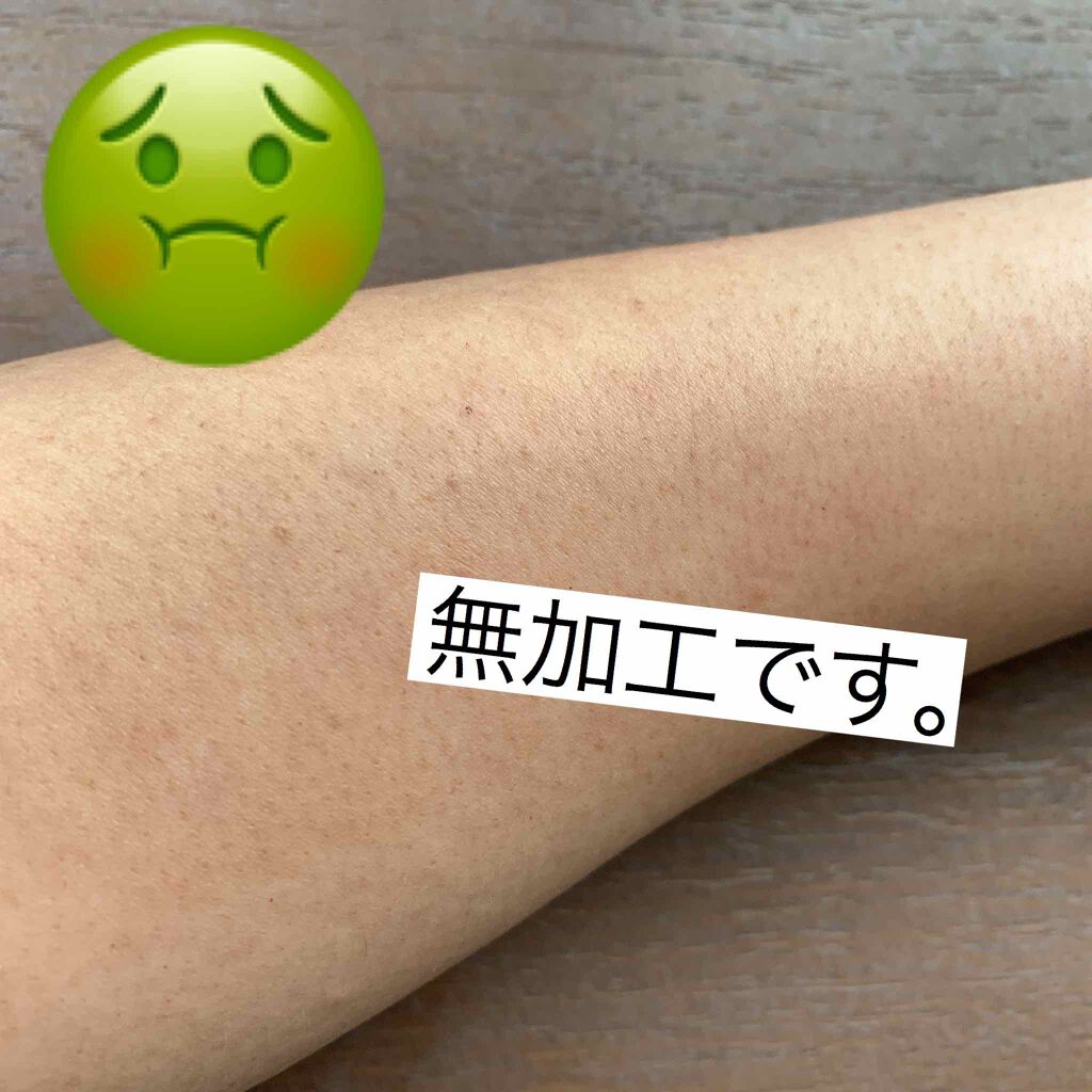 ニノキュア（医薬品）/ニノキュア/その他を使ったクチコミ（3枚目）