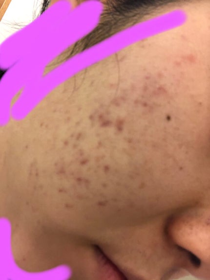 W・Sパスター PC/クロロフイル/シートマスク・パックを使ったクチコミ(1枚目)