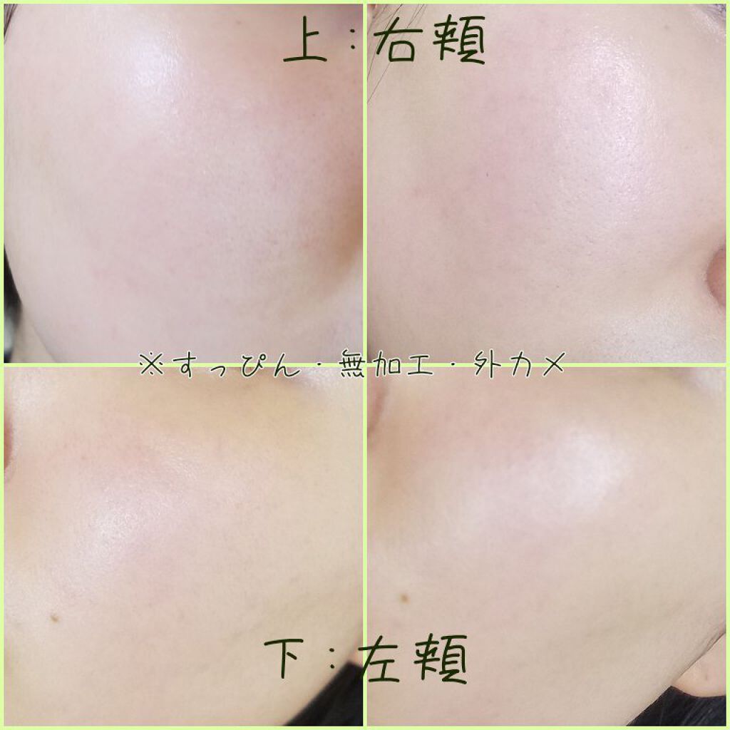 シカゴ シカダブルエフェクトアンプル Isoiの効果に関する口コミ 敏感肌におすすめの美容液 こんにちはこんばんは By 紅子 敏感肌 代前半 Lips