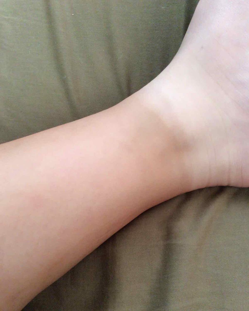 ハトムギ化粧水(ナチュリエ スキンコンディショナー R )/ナチュリエ/化粧水を使ったクチコミ（2枚目）