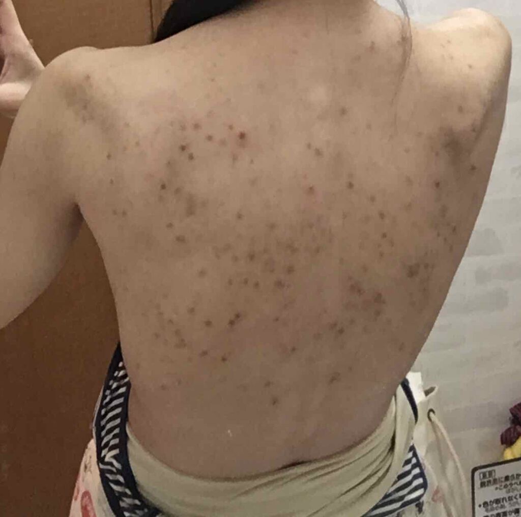 ロゼットゴマージュ/ロゼット/ピーリングを使ったクチコミ(2枚目)