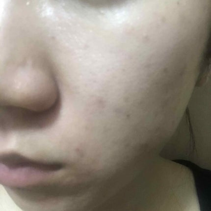 フェイシャル トリートメント エッセンス/SK-II/化粧水を使ったクチコミ(2枚目)