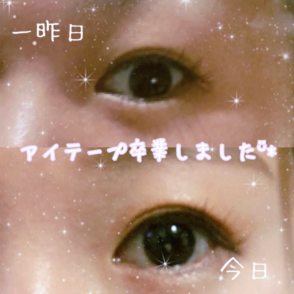 オリシキ アイリッドスキンフィルム /D-UP/二重まぶた用アイテムを使ったクチコミ(2枚目)