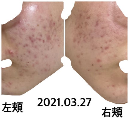 を使ったクチコミ(1枚目)