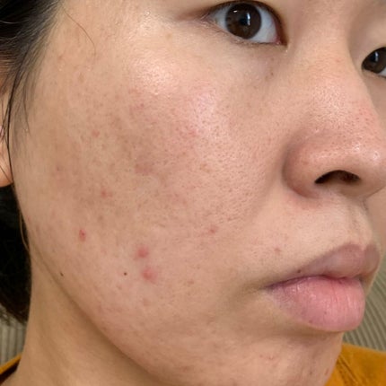 パフォーマンスツール トライアルセット/LOGIC/トライアルキットを使ったクチコミ(10枚目)