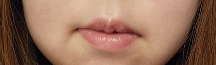 オールマイシングス トゥルービューティ キス リッププランパー/all my things/リッププランパーを使ったクチコミ(1枚目)