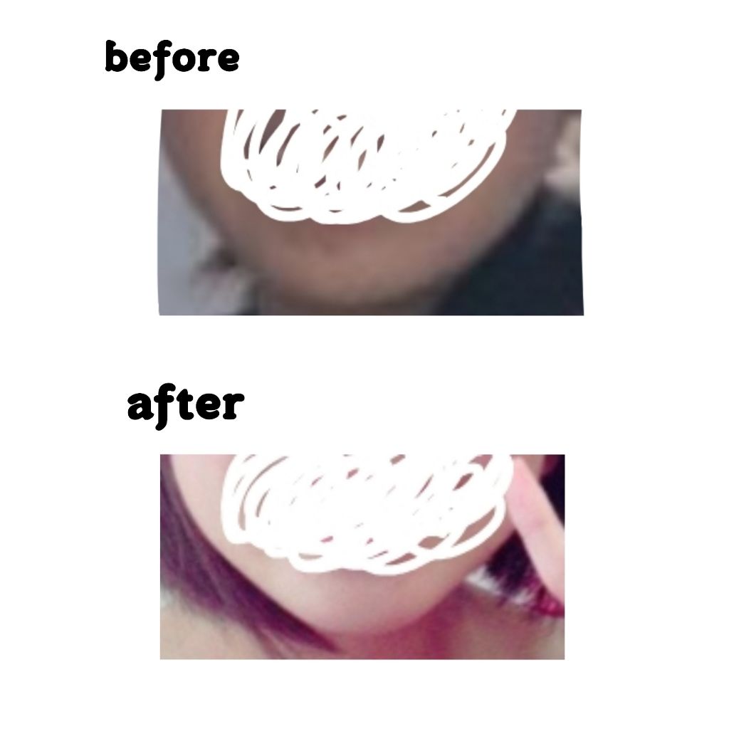 メイク落とし パーフェクトオイル/ビオレ/オイルクレンジングを使ったクチコミ（2枚目）