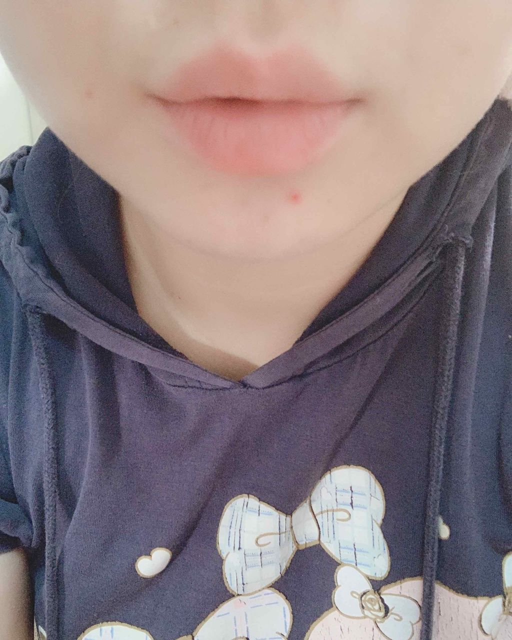 38°C / 99°F リップトリートメント (リップ美容液)/UZU BY FLOWFUSHI/リップケアを使ったクチコミ(2枚目)