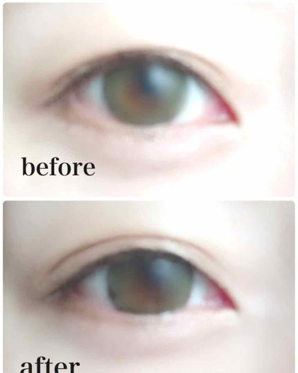 【旧品】オリシキ アイリッドスキンフィルム/D-UP/二重まぶた用アイテムを使ったクチコミ(3枚目)