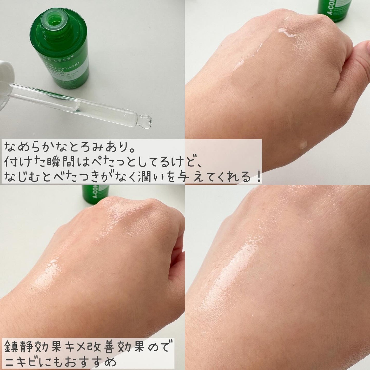 A-Control 10%アゼライックアシッドセラム/NINELESS/美容液を使ったクチコミ(8枚目)