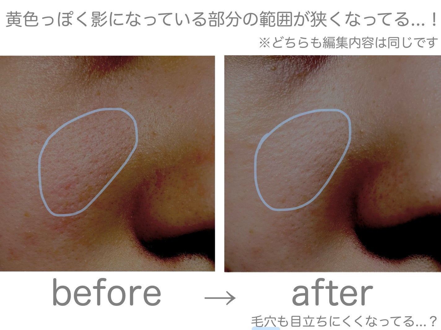 トーンアップホワイト マッドマスク/by : OUR/シートマスク・パックを使ったクチコミ(5枚目)