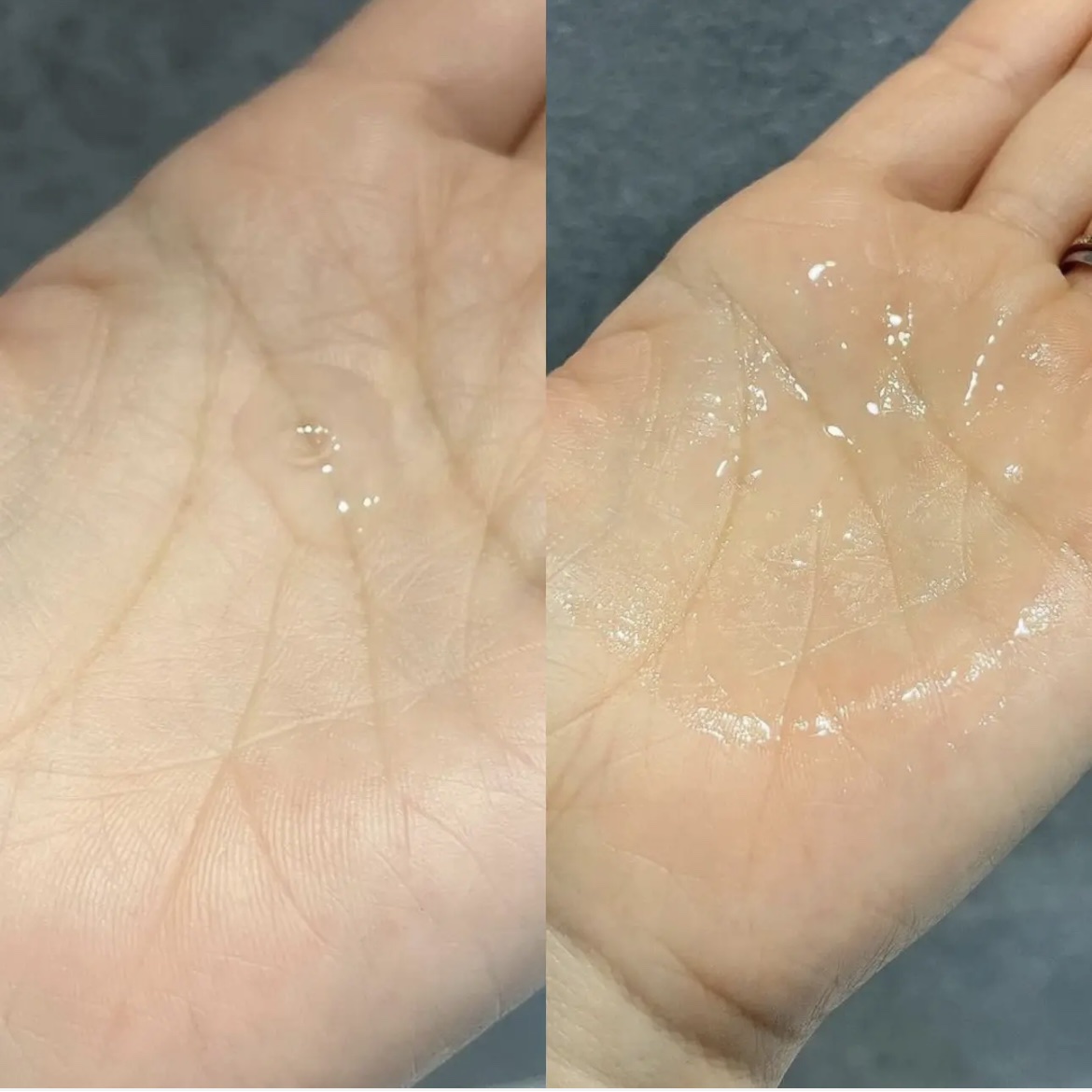 ファイン100/imini/美容液を使ったクチコミ（3枚目）