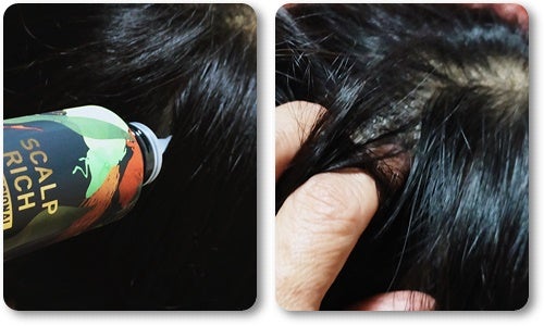 スカルプリッチ プロフェッショナル/日清食品/頭皮ローションを使ったクチコミ(5枚目)