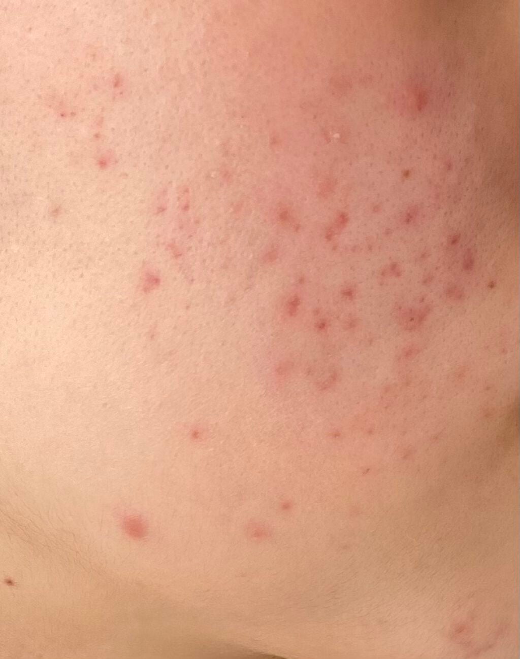 乳液・敏感肌用・高保湿タイプ/無印良品/乳液を使ったクチコミ(2枚目)