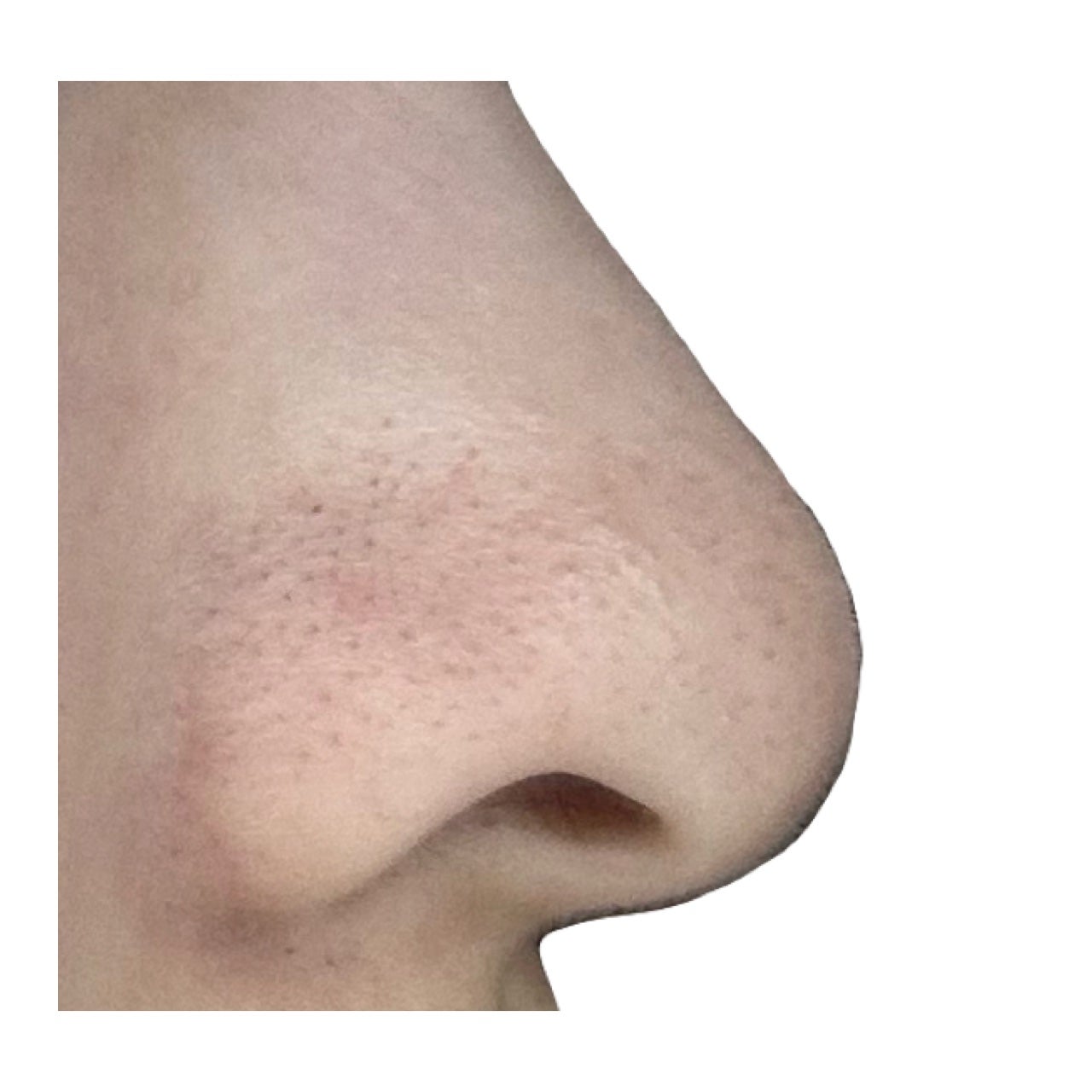 アンドハニー クレンジングバーム ブラック/&honey/クレンジングバームを使ったクチコミ(8枚目)