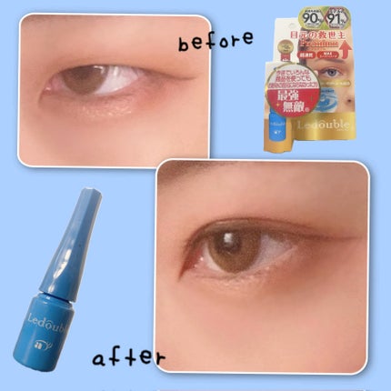 ルドゥーブル プレミアム/ルドゥーブル/二重まぶた用アイテムを使ったクチコミ(1枚目)