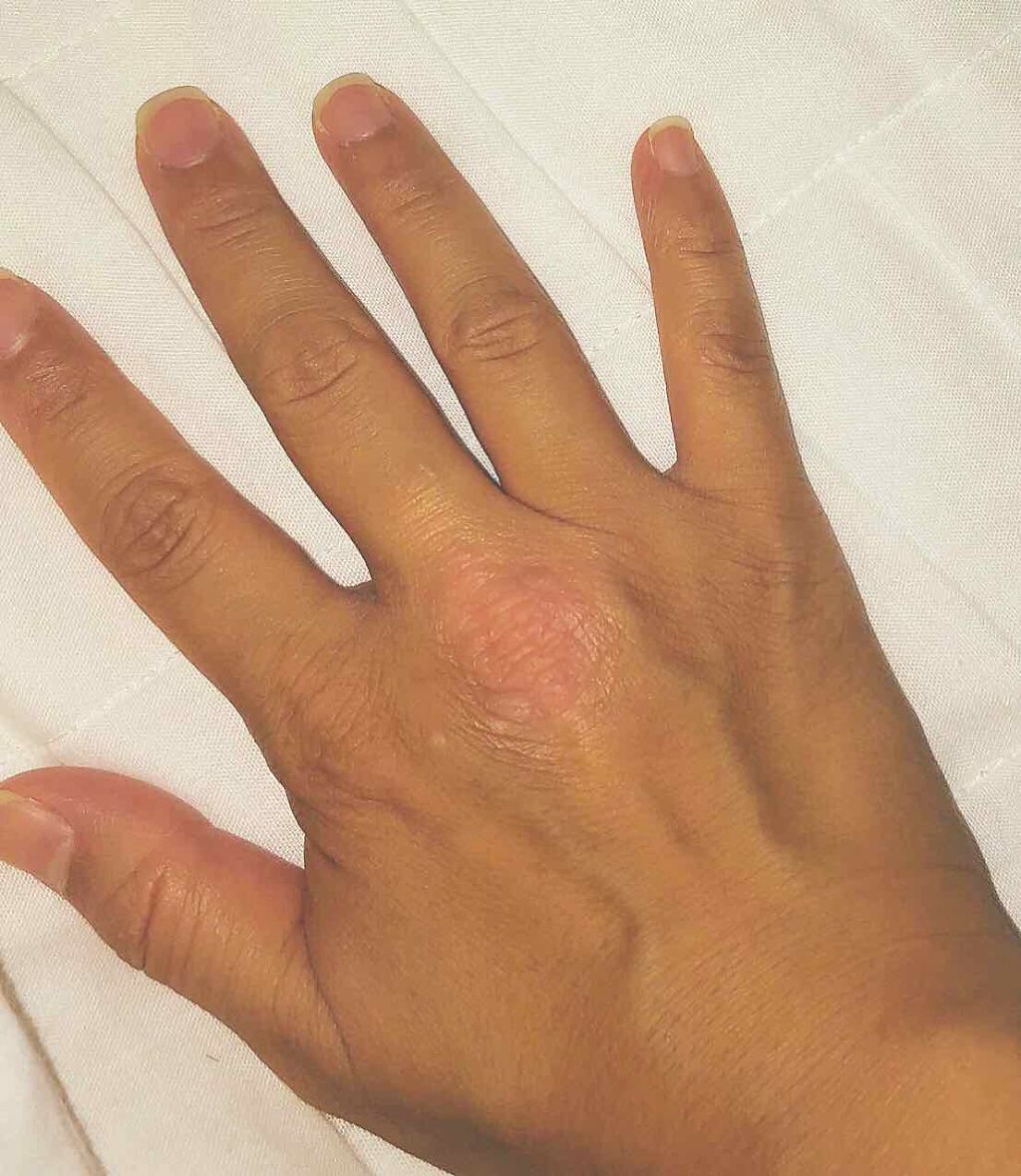 メディカルクリームG(薬用クリームG)/メンターム/ハンドクリームを使ったクチコミ(2枚目)