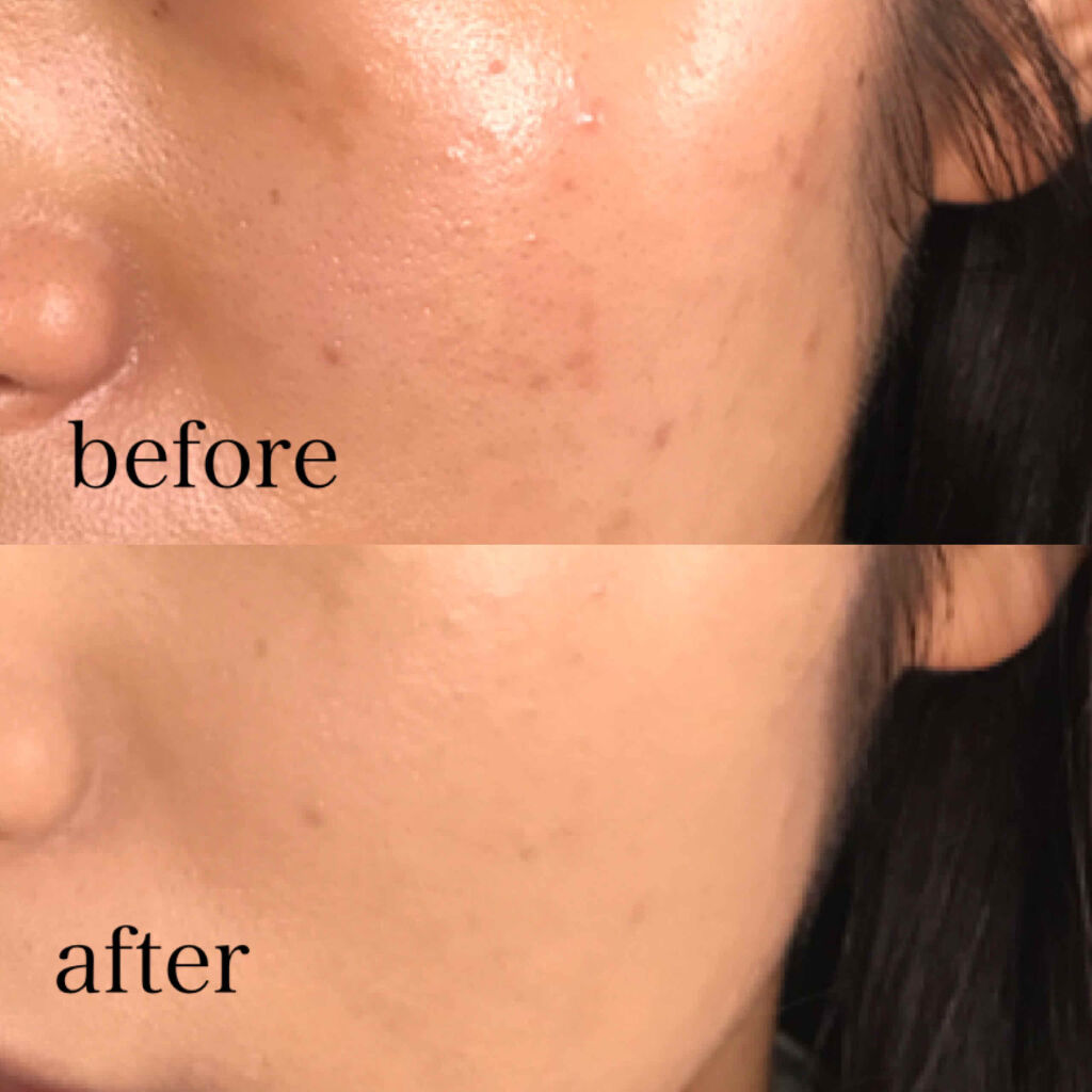 （旧）アンリミテッド ラスティング フルイド/shu uemura/リキッドファンデーションを使ったクチコミ（2枚目）