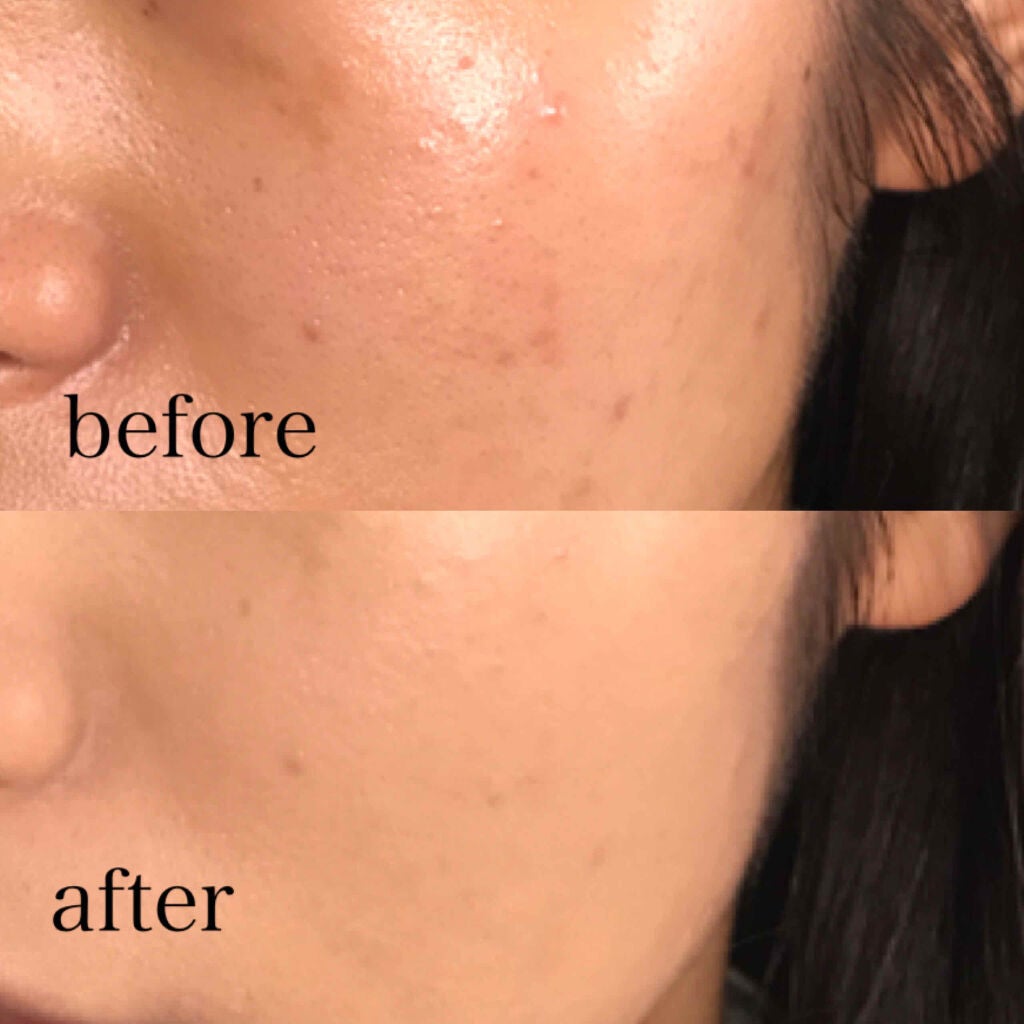 ïŒæ§ïŒã¢ã³ãªãããã ã©ã¹ãã£ã³ã° ãã«ã€ã/shu uemura/ãªããããã¡ã³ããŒã·ã§ã³ã䜿ã£ãã¯ãã³ãïŒ2æç®ïŒ