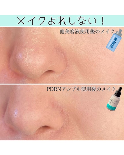 PDRN+ デイリーマスク/VT/シートマスク・パックを使ったクチコミ(3枚目)