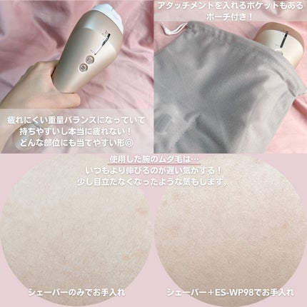 光美容器 光エステ<ボディ&フェイス用> ES-WP98/Panasonic/家庭用脱毛器を使ったクチコミ(4枚目)