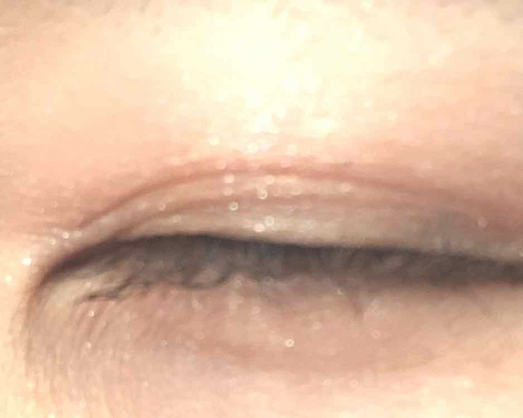 あらきは後頭部ハゲ on LIPS 「⚠️2枚目以降目のどアップ画像苦手な方ごめんなさい🙇♀️こん..」(4枚目)