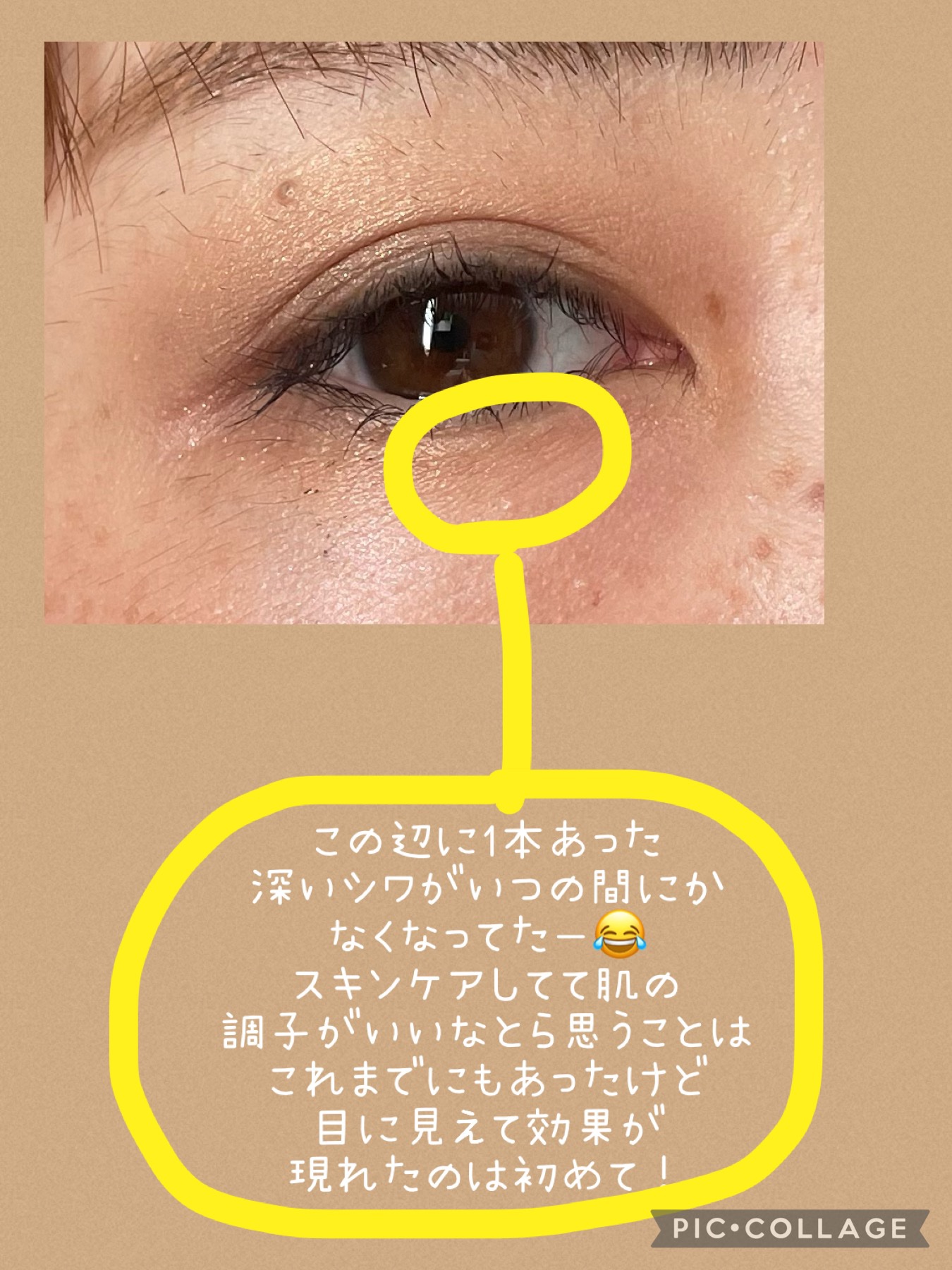 レチノールA 1% アドバンスドリバイタリゼーションクリーム/Life-flo/フェイスクリームを使ったクチコミ（2枚目）