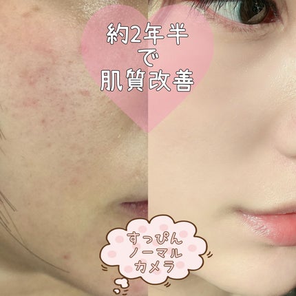 を使ったクチコミ(1枚目)