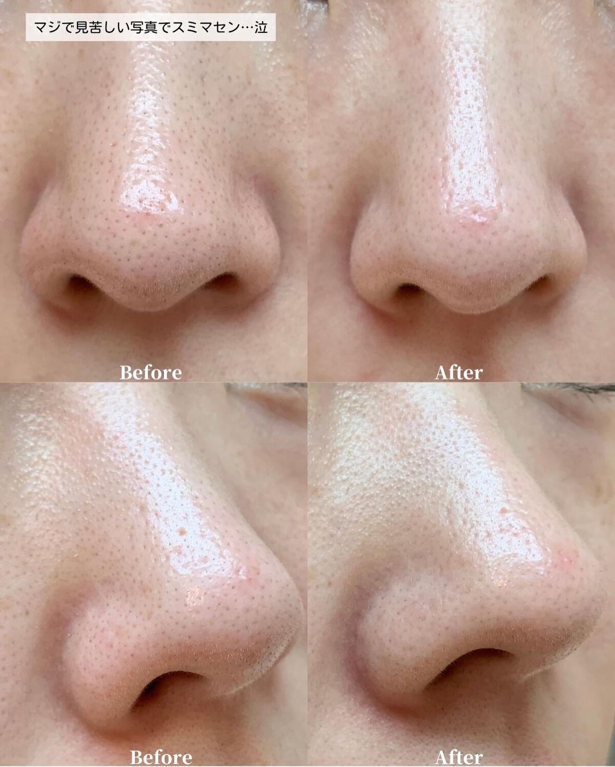 ケコ|アラサー韓コスマニア on LIPS 「【BeautiTopping×ケコ特別コラボ】@beautit..」(5枚目)