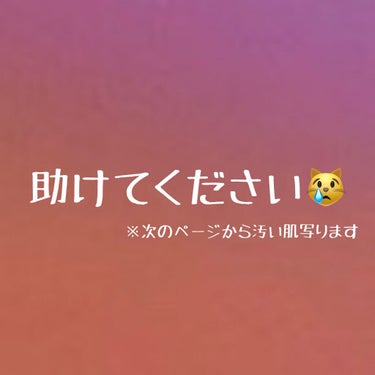 メラノCC 薬用しみ集中対策 プレミアム美容液のクチコミ「[助けてください]

はじめまして たこと申します 新高校生です 私がニキビに悩んでいて助けて.....」（1枚目）